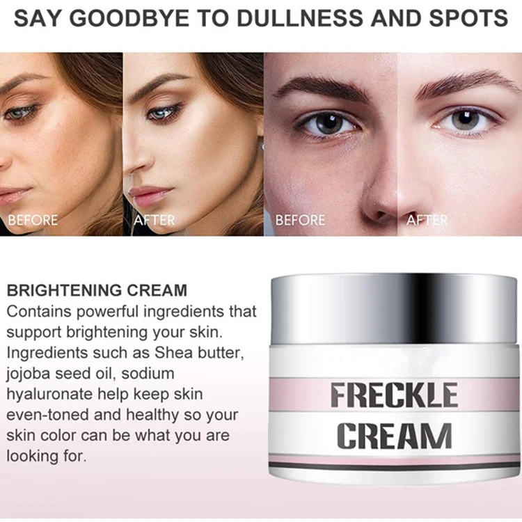 Factory Professional Pigment Spots Remover Skin Lightening Cream Freckle Cream