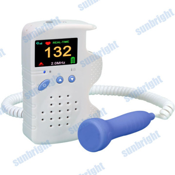 handheld fetal doppler