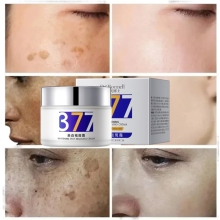 Freckle Reduction Cream 377 Formula with Nicotinamide
