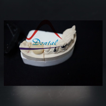 Dental Zirconia Crown and Bridge