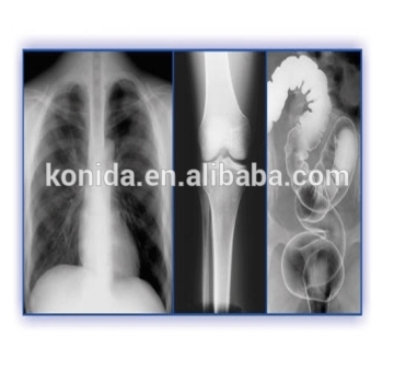 konida medical dry imaging film pcb dry film