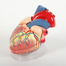 Anatomical Jumbo Heart Model: A Detailed New Style Representation of the Enlarged Heart