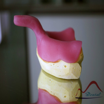 Light Cured Reain Special Tray