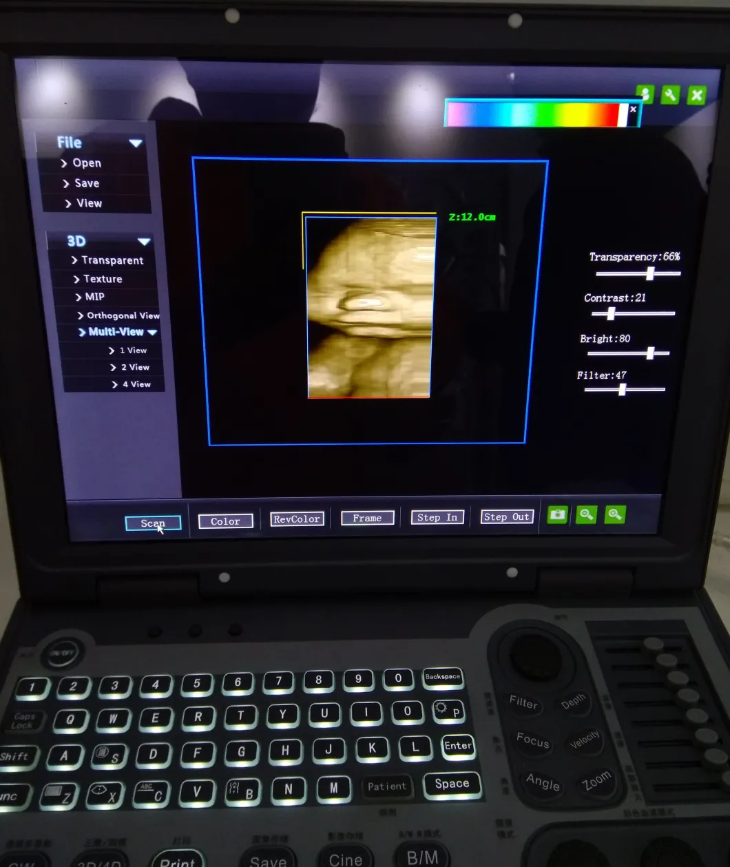 Upgraded Version Laptop Color Doppler Ultrasound Machine