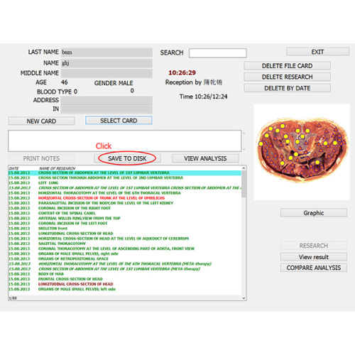 diagnostics Scanner 8d nls 9d nls health analyzer