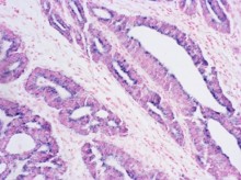 In Situ Hybridization(ISH)