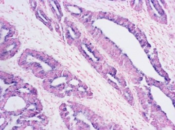 In Situ Hybridization(ISH)