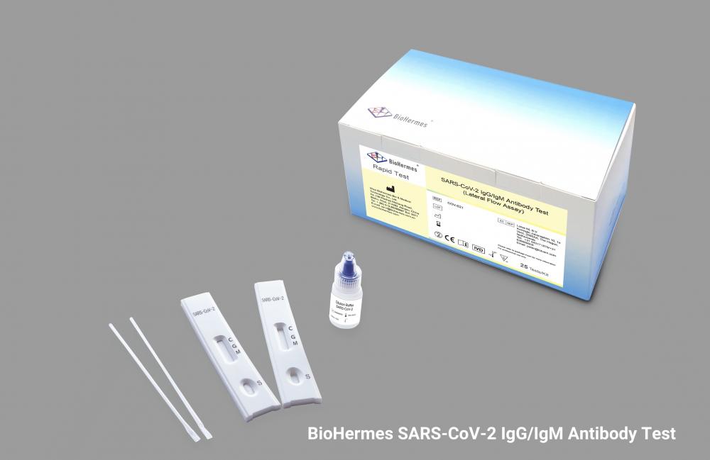 Δοκιμή ανοσοσφαιρίνης SARS-CoV-2