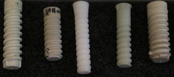 Railroad Nylon Lock Screw Dowel