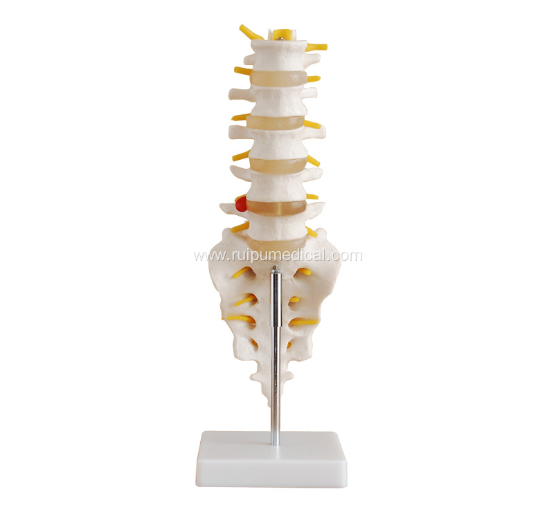 Medical Life-Size Lumbar Vertebrae