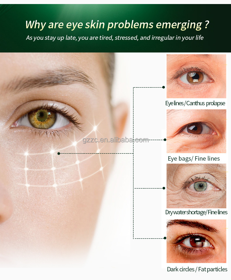20g eye cream private label for dark circles eye bags removal eye cream