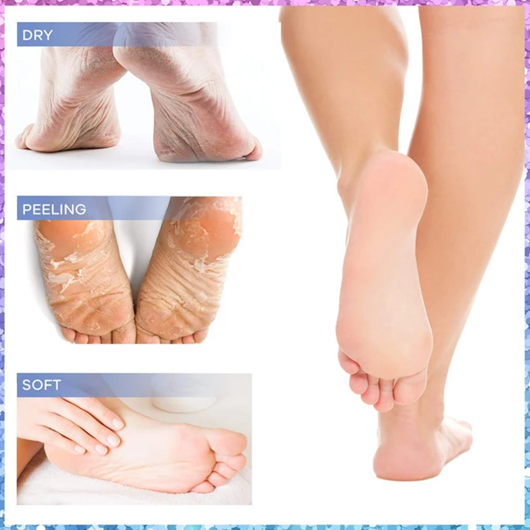 Custom Exfoliating Peeling Natural Treatment Dead Skin & Calluses Foot Peel Mask