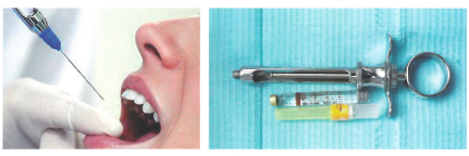 Dentistry Anesthetics