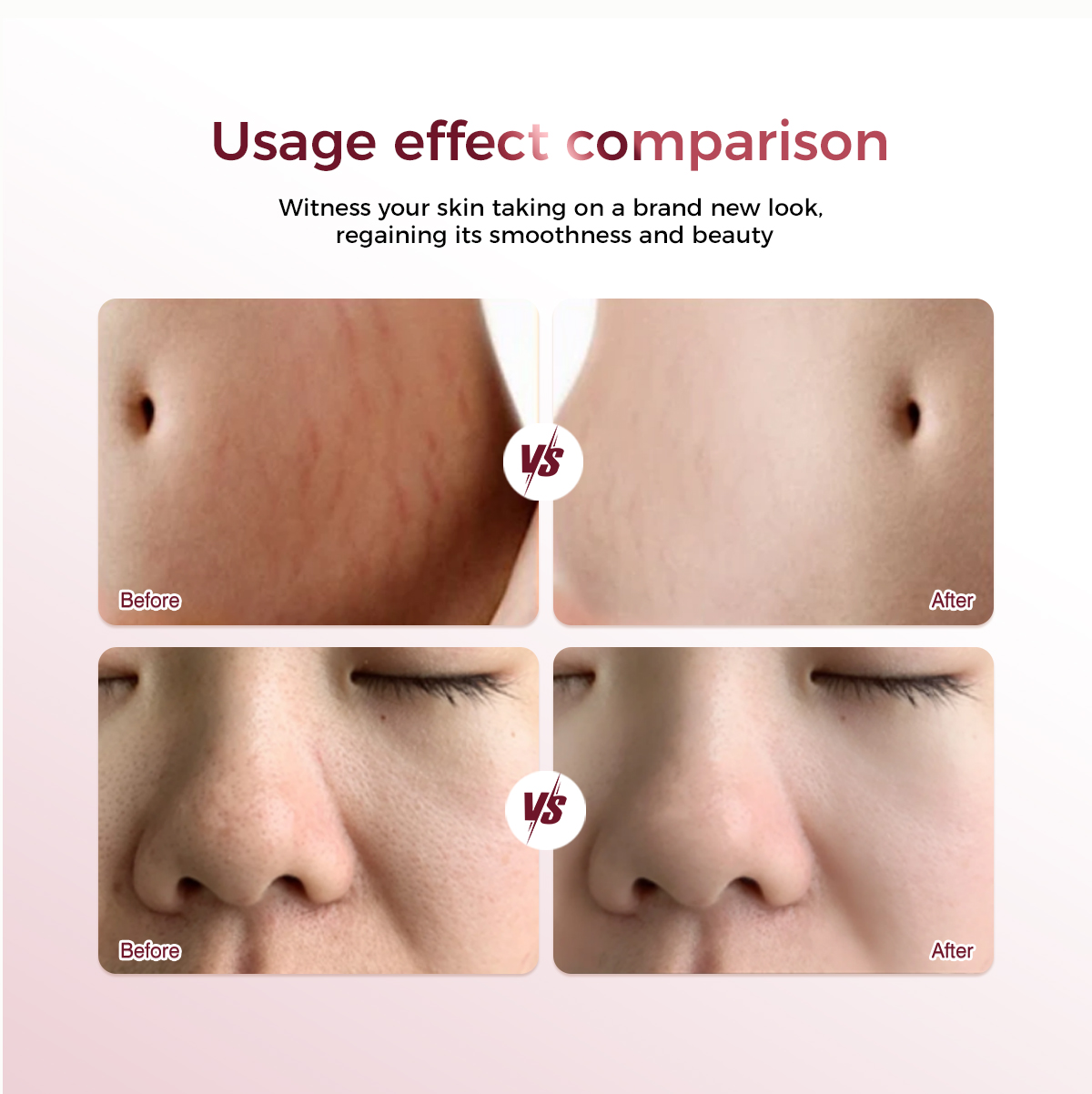 tratamento facial a laser laser facial