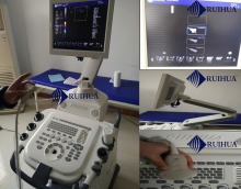 Echo Ultrasound Device Trolley type for pregnancy tests DU8-M7