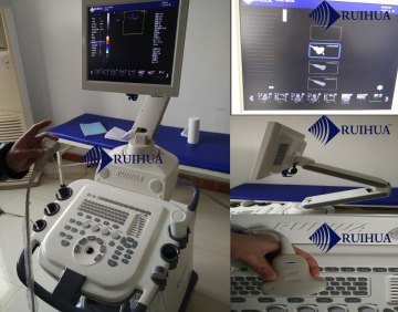 Echo Ultrasound Device Trolley type for pregnancy tests DU8-M7