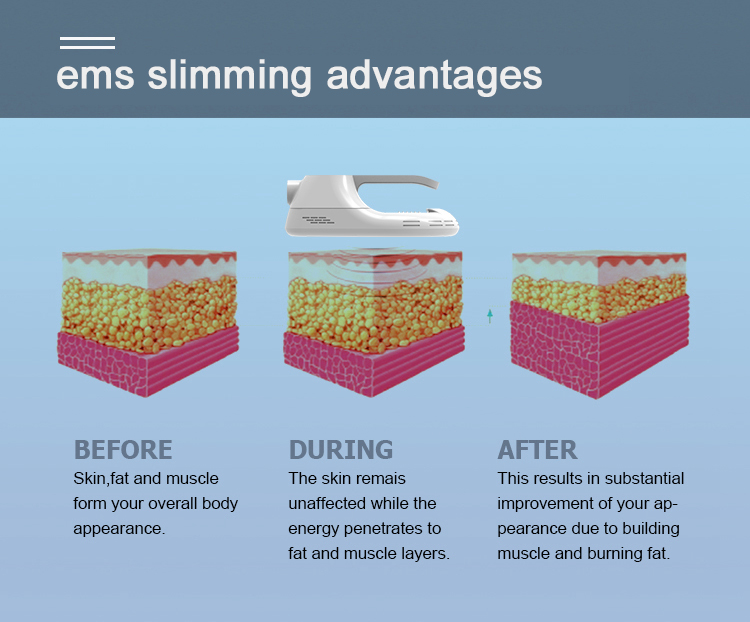 Ems Fat Burner Machine