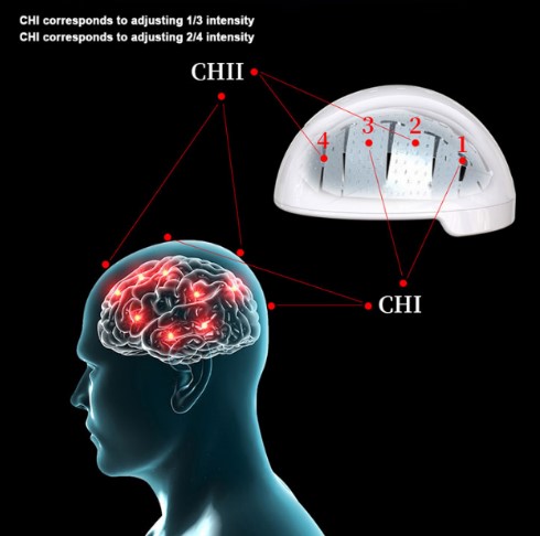 Casque de thérapie au laser pour guérir les troubles psychiatriques 810nm