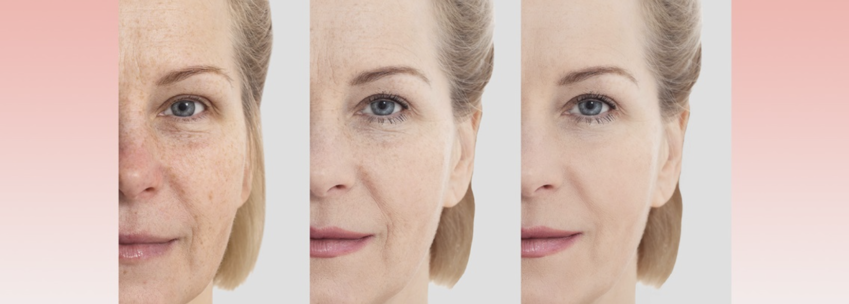 уход за кожей skin care