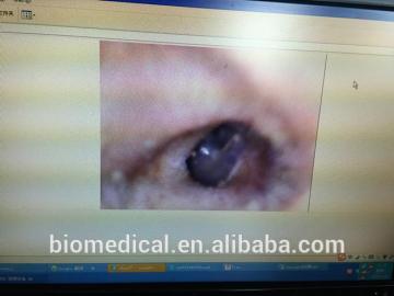 USB 2.0 interface ear inspection camera otoscope with resolution 640*480 software available