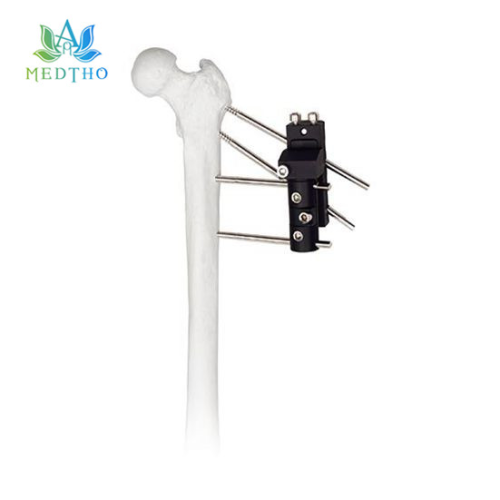 Fixator externe Hip