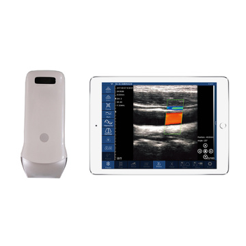 Handheld -Ultraschallmaschine iPad Ultraschallscanner