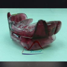 Anti Snoring Mouth Appliance