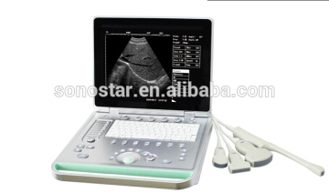 laptop ultrasound scanner