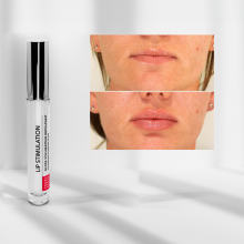 Anti-Aging Hydrating Lip Gloss for Thin Lips