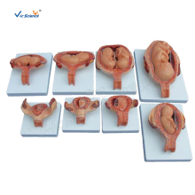 Half-Size The Development Process for Fetus Model
