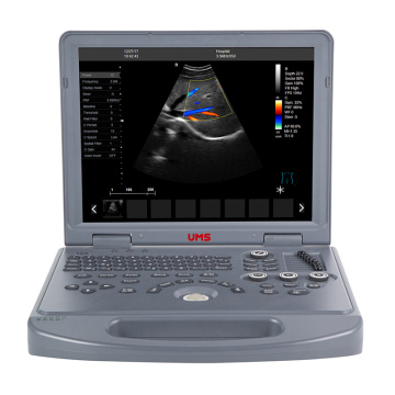 UW-L3 Laptop Color Doppler Ultrasound Scanner