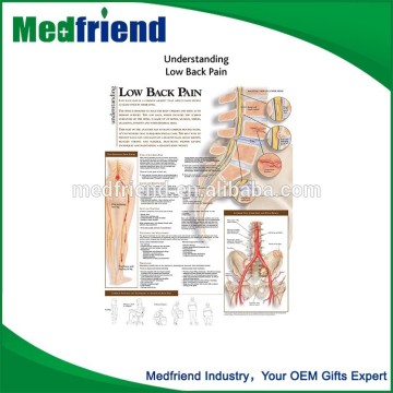 Gold Supplier China Understanding Low Back Pain Chart