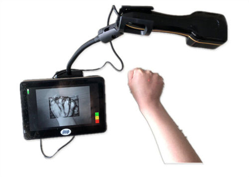 Tablet Medical Infrared Vein Finder z ekranem dotykowym