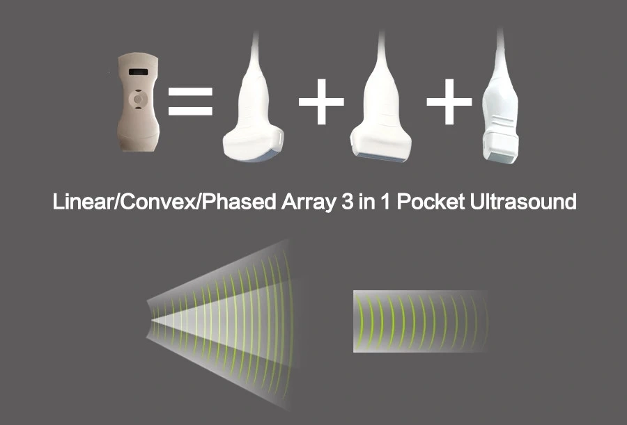 Ultrasound Scanner Portable Color Doppler Convex Probe