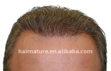 stock thin skin toupee