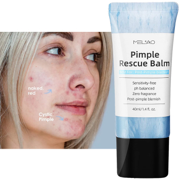 Blemish Sensitivity Ph Balanced Acne Pimples Treatment Cream