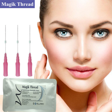 Best Lip Thread Lift for Upper Lip