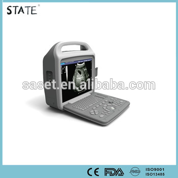 hot hospital and clinical protable ultrasonic diagnostic equipment