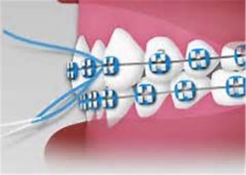Soft Orthodontic Dental Floss