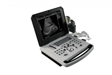 Notebook Black and White Ultrasound Machine for Obstetrics