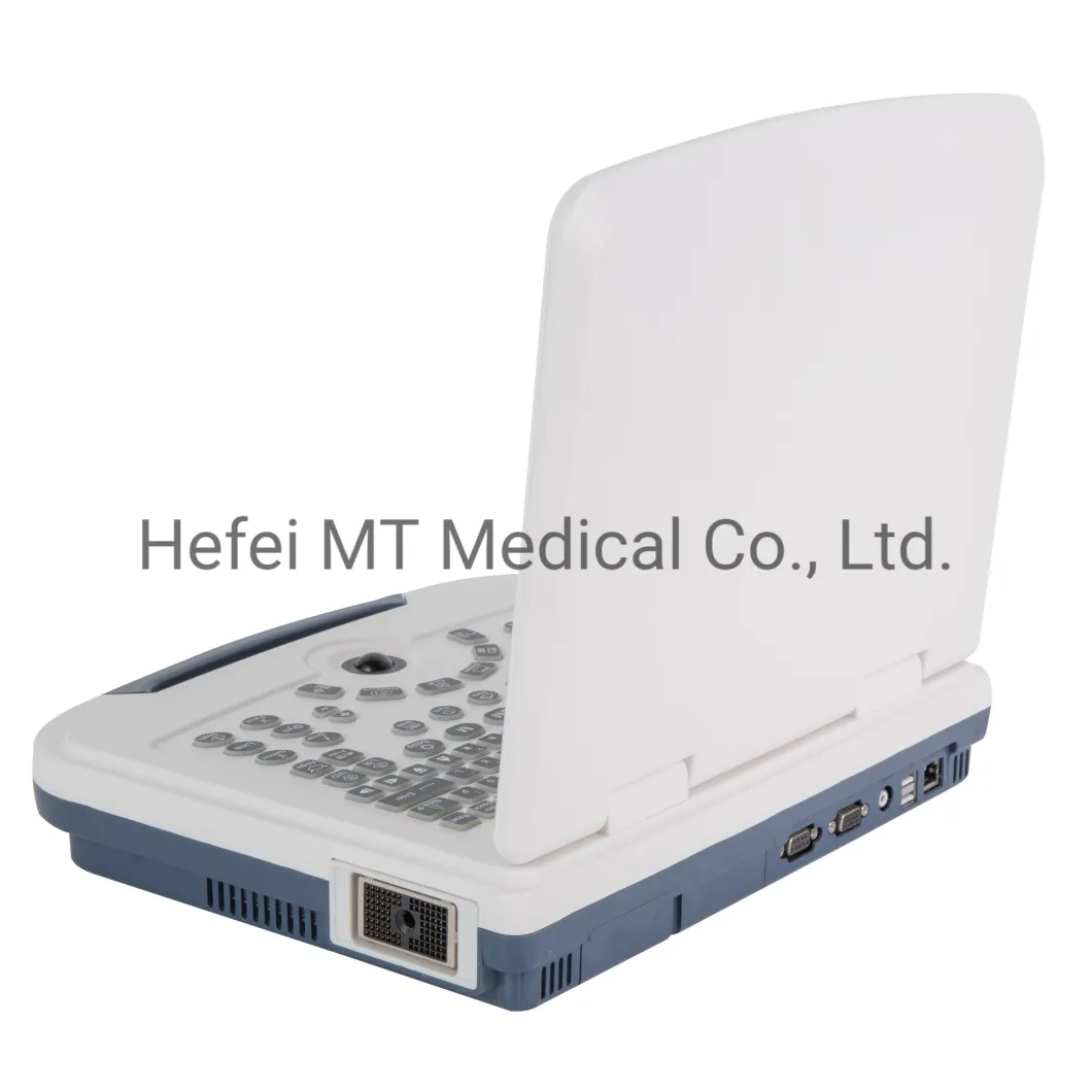 Mt Medical Hospital Portable Color Doppler Ultrasound