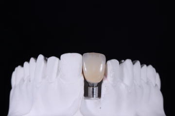 Zirconia Implant crown