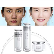 Hot Selling Facial Products For Professionals Skin Care Set For Dark Spots