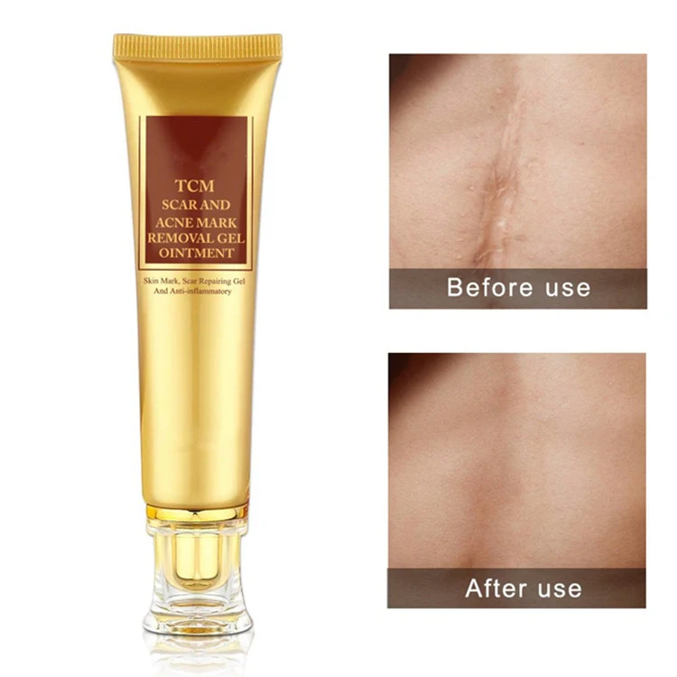 OEM/ODM Tcm Scar and Acne Marks Removal Gel Cream for Face & Body