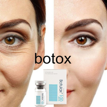 Wrinkle Removal Injectable Botolisemtoxin Toxin Type a