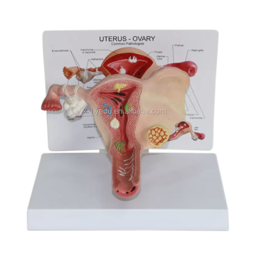 Female Reproductive System Anatomical Model