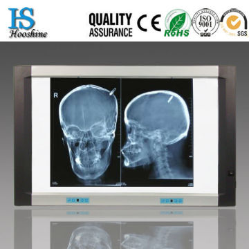 led x-ray film viewer