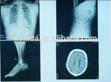 x ray film, dry film, x ray sex film image compatible fuji cr