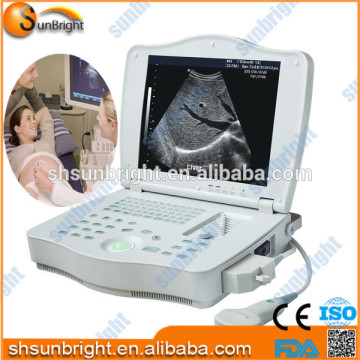 High cost performance B ultrasound / ultrasound equipment