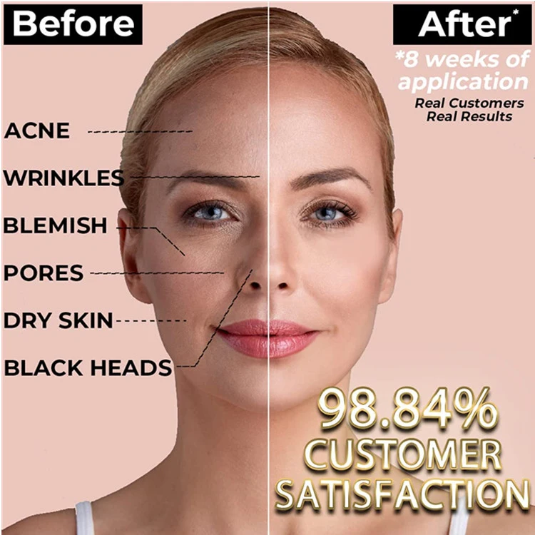 Collagen + Vitamin C Gold Clay Face Mask Anti Acne Blackheads Mask